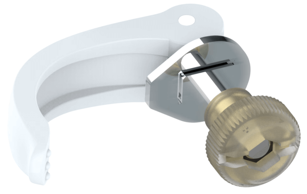 Speedlock-2